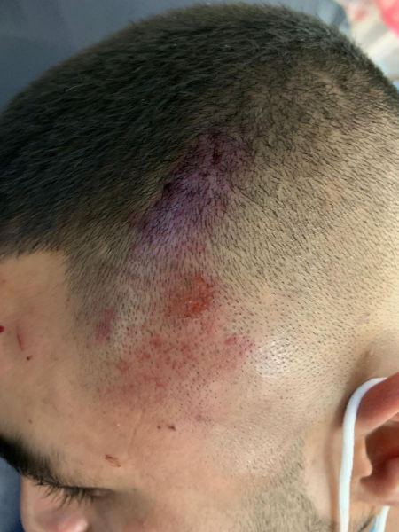 اعتداء عنصري على طلاب عرب في " رمات غان "